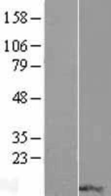 Western Blot: RPP14 Overexpression Lysate [NBL1-15552]