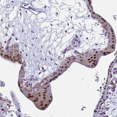 Immunohistochemistry-Paraffin: RPP20 Antibody [NBP2-13789]