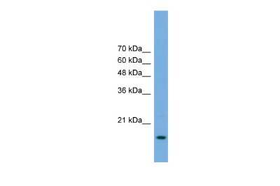 Western Blot: RPP20 Antibody [NBP2-85660]