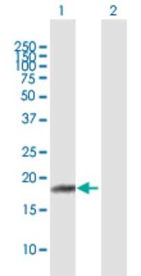 Western Blot: RPP21 Antibody [H00079897-B01P]