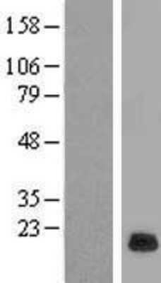 Western Blot: RPP21 Overexpression Lysate [NBL1-15553]