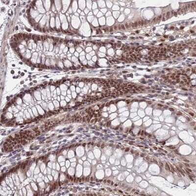 Immunohistochemistry-Paraffin: RPP25 Antibody [NBP1-92349]