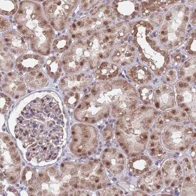 Immunohistochemistry-Paraffin: RPP25 Antibody [NBP1-92349]