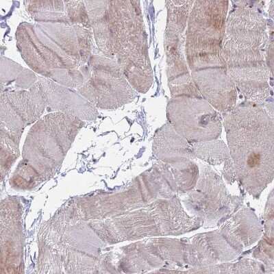 Immunohistochemistry-Paraffin: RPP25 Antibody [NBP1-92349]