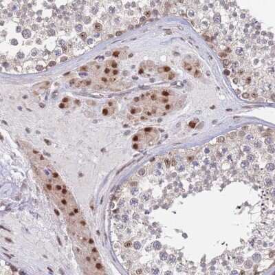 Immunohistochemistry-Paraffin: RPP25 Antibody [NBP1-92349]