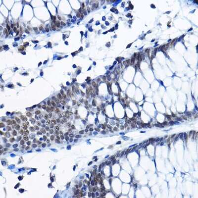 Immunohistochemistry-Paraffin: RPP25 Antibody - BSA Free [NBP2-94328]