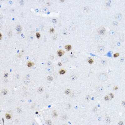 Immunohistochemistry-Paraffin: RPP25 Antibody - BSA Free [NBP2-94328]