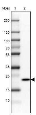 Western Blot: RPP25 Antibody [NBP1-92349]