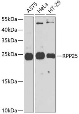 Western Blot: RPP25 AntibodyBSA Free [NBP2-94328]