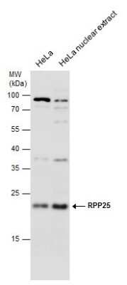 Western Blot: RPP25 Antibody [NBP3-12930]