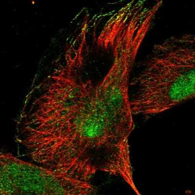 Immunocytochemistry/ Immunofluorescence: RPP30 Antibody [NBP1-80658]