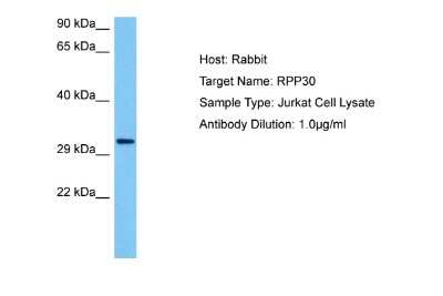 Western Blot: RPP30 Antibody [NBP2-85662]