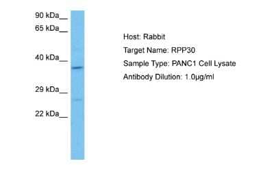 Western Blot: RPP30 Antibody [NBP2-85663]