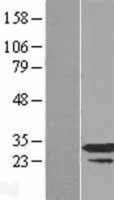 Western Blot: RPP30 Overexpression Lysate [NBL1-15554]