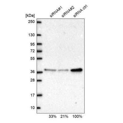 Western Blot: RPP38 Antibody [NBP2-13260]