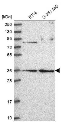 Western Blot: RPP38 Antibody [NBP2-68691]