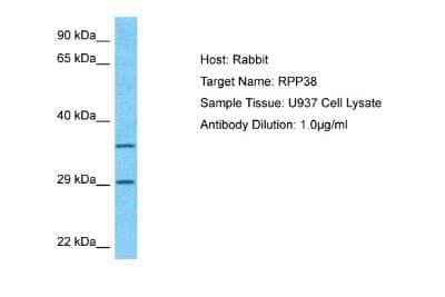 Western Blot: RPP38 Antibody [NBP2-85665]