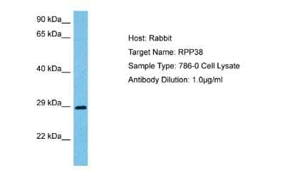 Western Blot: RPP38 Antibody [NBP2-85666]