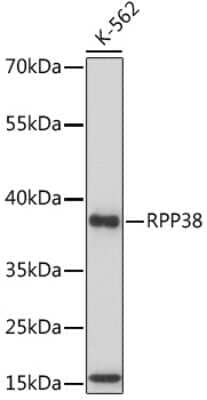 Western Blot: RPP38 AntibodyAzide and BSA Free [NBP2-94050]