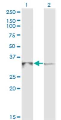 Western Blot: RPP40 Antibody (1G8) [H00010799-M03]