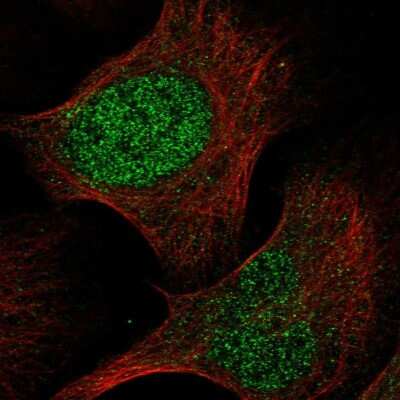 Immunocytochemistry/ Immunofluorescence: RPP40 Antibody [NBP1-88765]