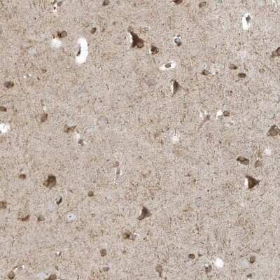 Immunohistochemistry-Paraffin: RPP40 Antibody [NBP1-88765]