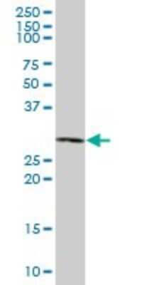 Western Blot: RPP40 Antibody [H00010799-B01P]