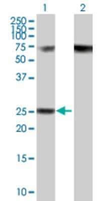 Western Blot: RPP40 Antibody [H00010799-B01P]