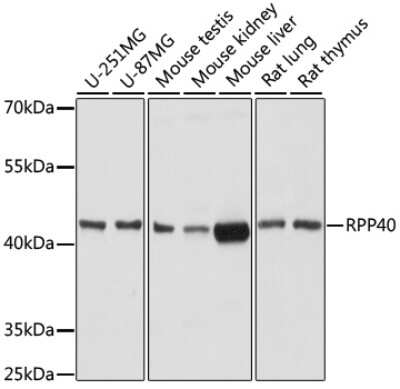 Western Blot: RPP40 AntibodyAzide and BSA Free [NBP2-93071]