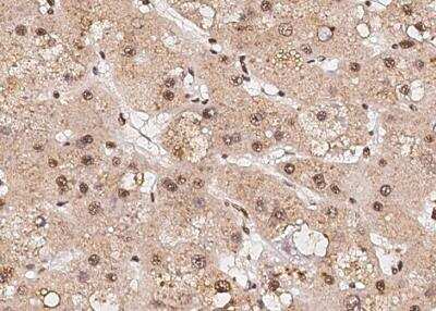 Immunohistochemistry-Paraffin: RPRD1B Antibody (08) [NBP3-06521]