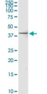 Western Blot: RPRD1B Antibody (4D6) [H00058490-M04]