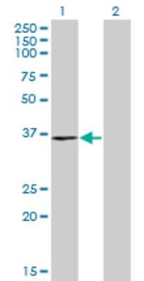 Western Blot: RPRD1B Antibody (4D6) [H00058490-M04]