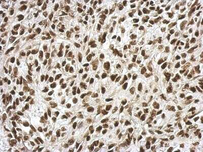 Immunohistochemistry-Paraffin: RPRD1B Antibody [NBP2-20222]