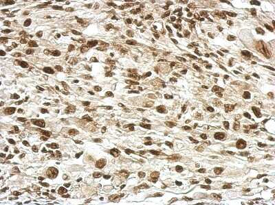 Immunohistochemistry-Paraffin: RPRD1B Antibody [NBP2-20222]