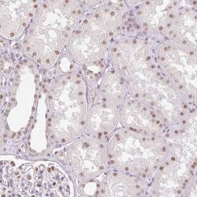 Immunohistochemistry-Paraffin: RPRD1B Antibody [NBP2-55788]