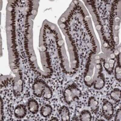 Immunohistochemistry-Paraffin: RPRD1B Antibody [NBP3-17643]