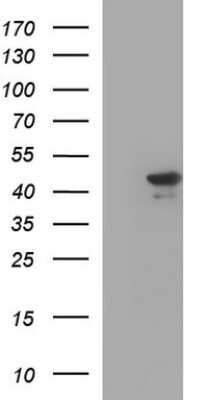 Western Blot: RPRD1B Antibody (OTI1C7)Azide and BSA Free [NBP2-73945]