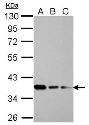 Western Blot: RPRD1B Antibody [NBP2-20222]