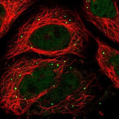 Immunocytochemistry/ Immunofluorescence: RPRD2 Antibody [NBP2-56292]