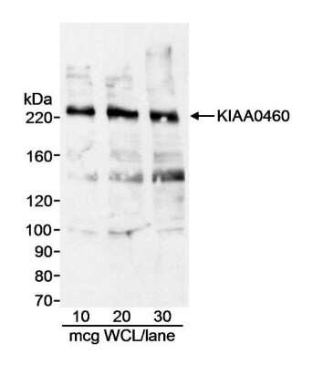 Western Blot: RPRD2 Antibody [NB100-366]