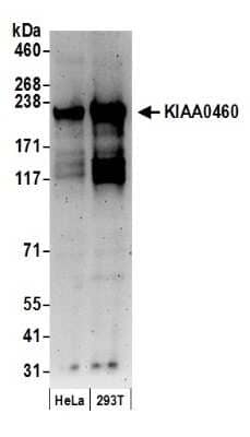 Western Blot: RPRD2 Antibody [NB100-366]