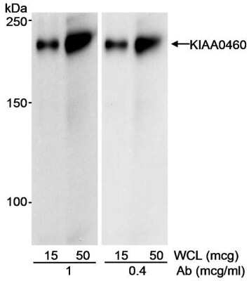 Western Blot: RPRD2 Antibody [NBP1-97932]