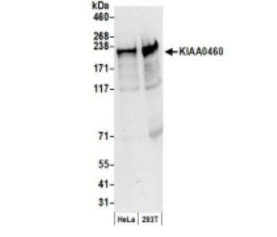 Western Blot: RPRD2 Antibody [NBP1-97932]