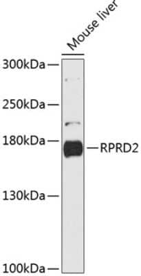 Western Blot: RPRD2 AntibodyAzide and BSA Free [NBP2-94280]