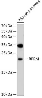 Western Blot: RPRM AntibodyBSA Free [NBP2-95120]