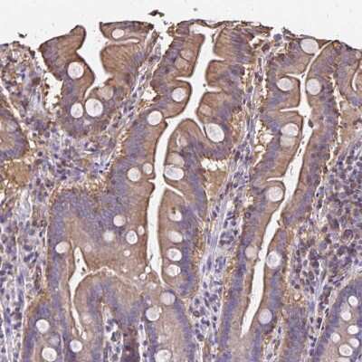 Immunohistochemistry-Paraffin: RPRML Antibody [NBP2-37999]