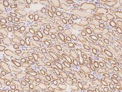 Immunohistochemistry-Paraffin: RPRML Antibody [NBP3-06313]