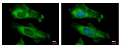 Immunocytochemistry/ Immunofluorescence: RPS10 Antibody [NBP1-31357]