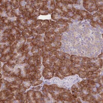 Immunohistochemistry-Paraffin: RPS10 Antibody [NBP2-48870]