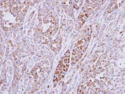 Immunohistochemistry-Paraffin: RPS10 Antibody [NBP1-31357]